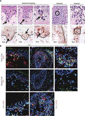 Cellular activation pathways and interaction networks in vascularized composite allotransplantation